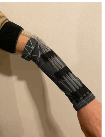 Prototype 2: dark compression sleeve with 3D-printed TPU anchors organizing the tubes along the forearm